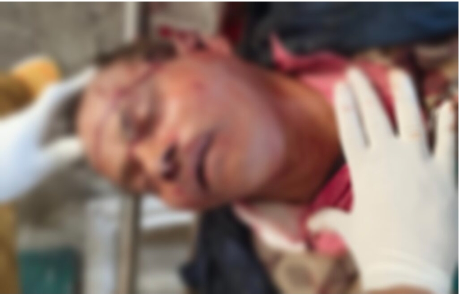 हरिद्वार हाइवे पर बाइक सवार रेलवे विभाग के अवर अभियन्ता की बाइक स्लिप होने से हुई मौत पत्नी घायल  बाइक सवार रेलवे अवर अभियंता सायब बच जाता अगर अपने सिर पर हेलमेट लगाया होता तो